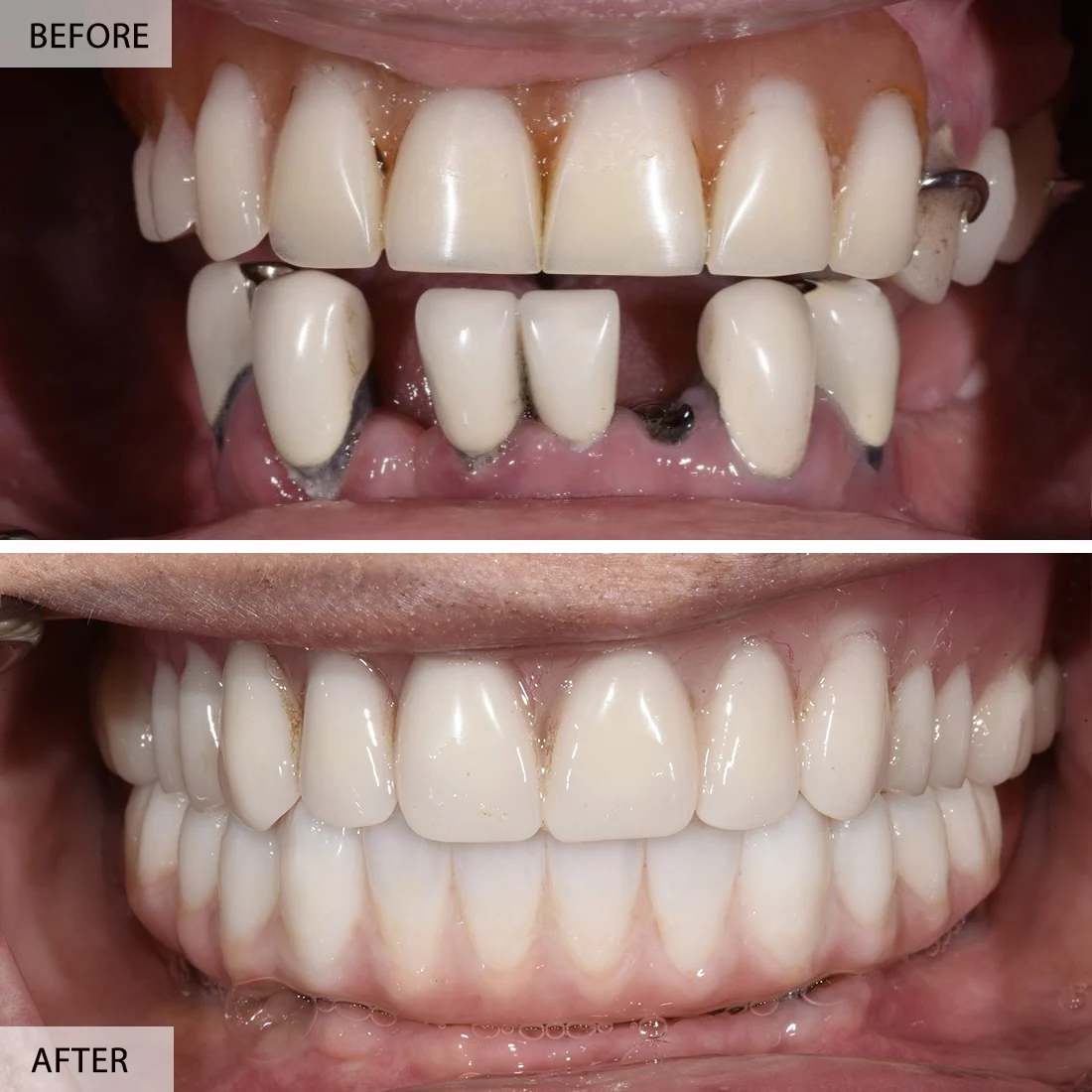 علاجات تجميل الأسنان