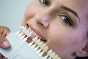 Hollywood Smile in Turkey