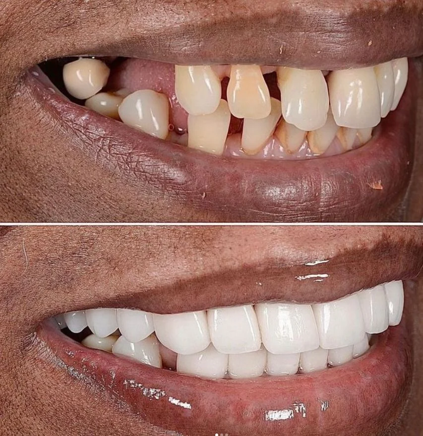 علاجات تجميل الأسنان